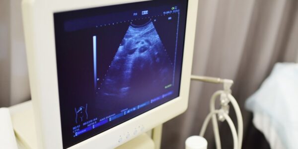 Bezpieczeństwo USG w czasie ciąży - czy jest to bezpieczne rozwiązanie?